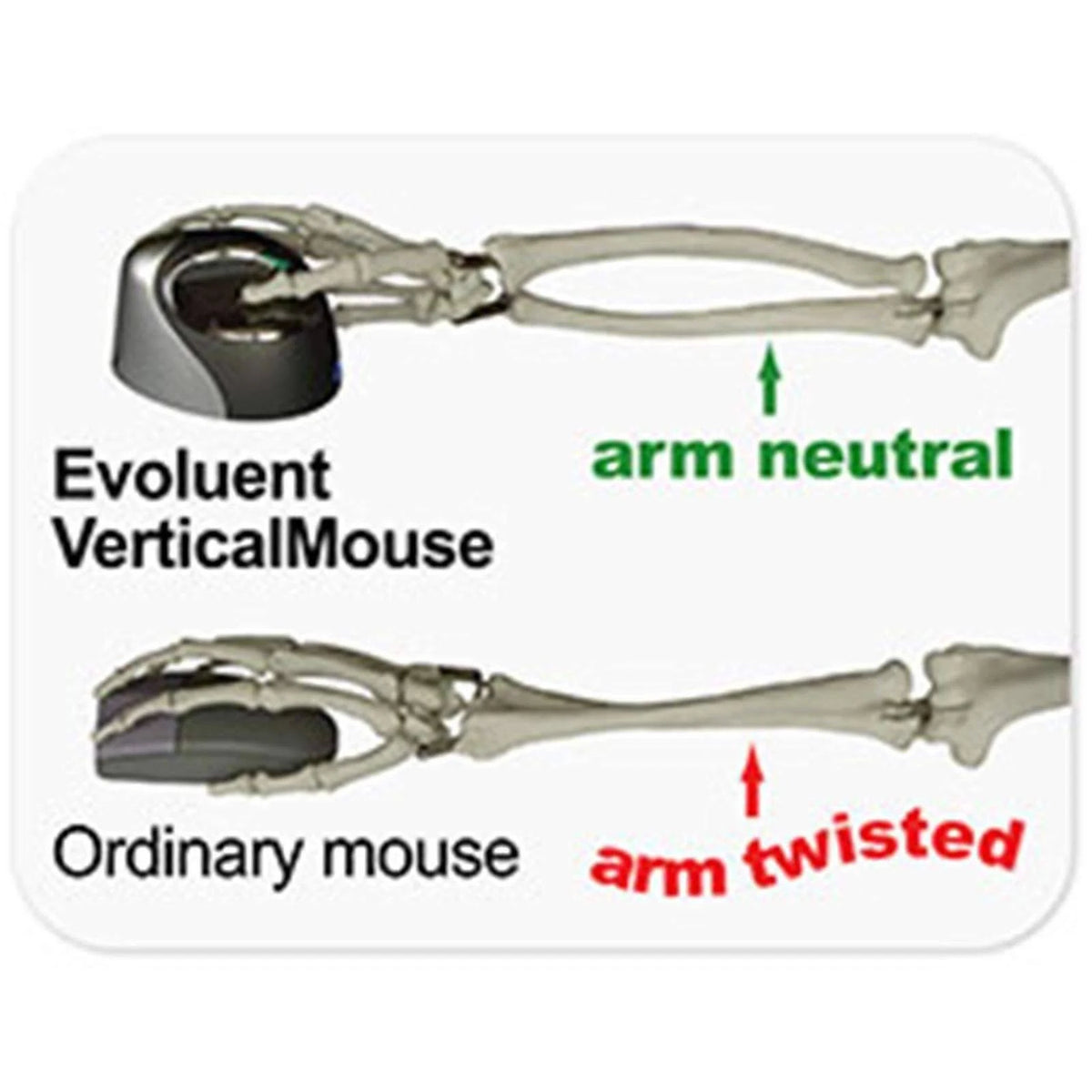 VerticalMouse 4 Right Mouse I803