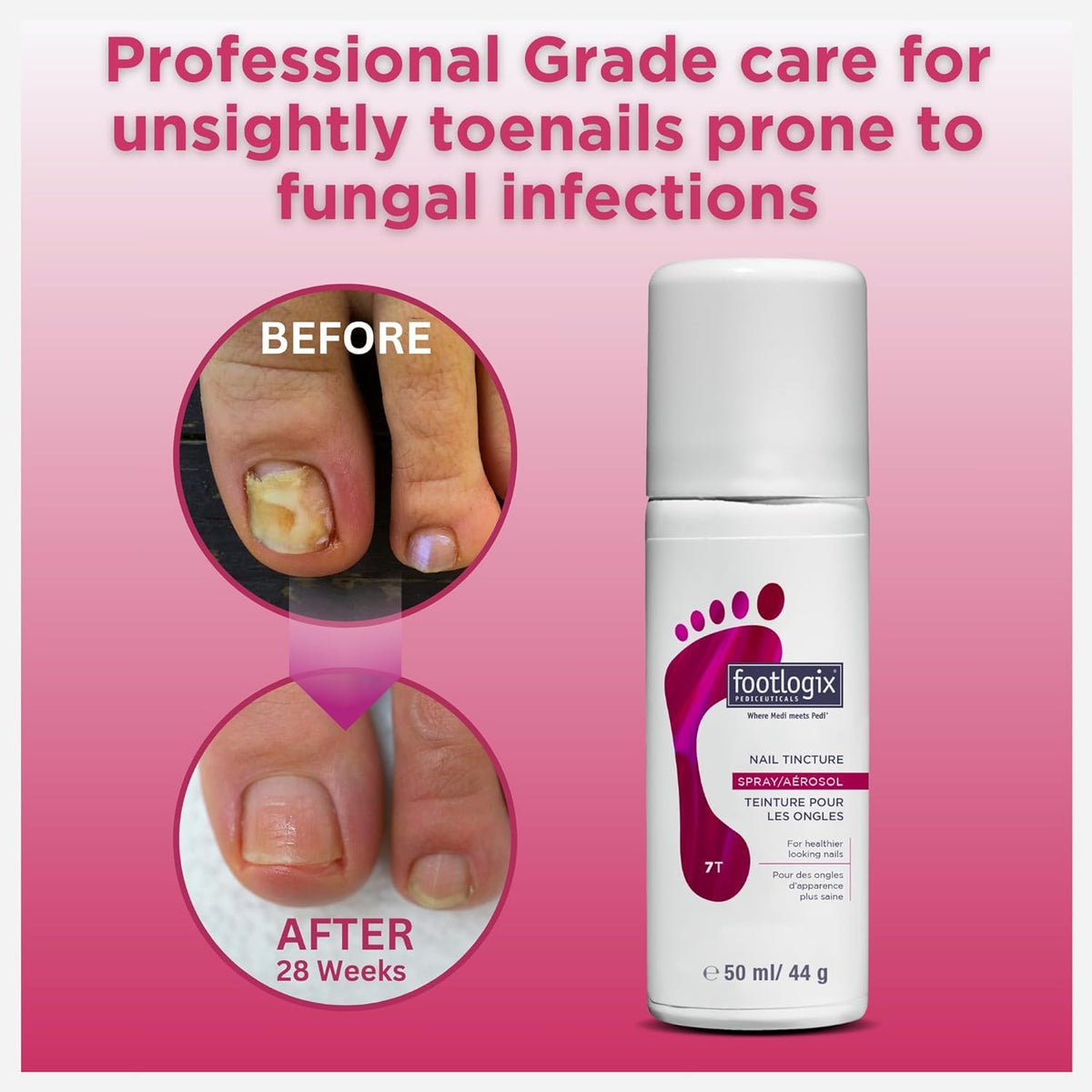 1.7 Fl Oz Anti-Fungal Toe Tincture Spray Z391465