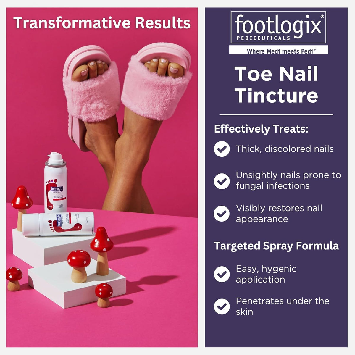 1.7 Fl Oz Anti-Fungal Toe Tincture Spray Z391465